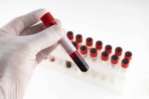 Blood Analysis Melbourne